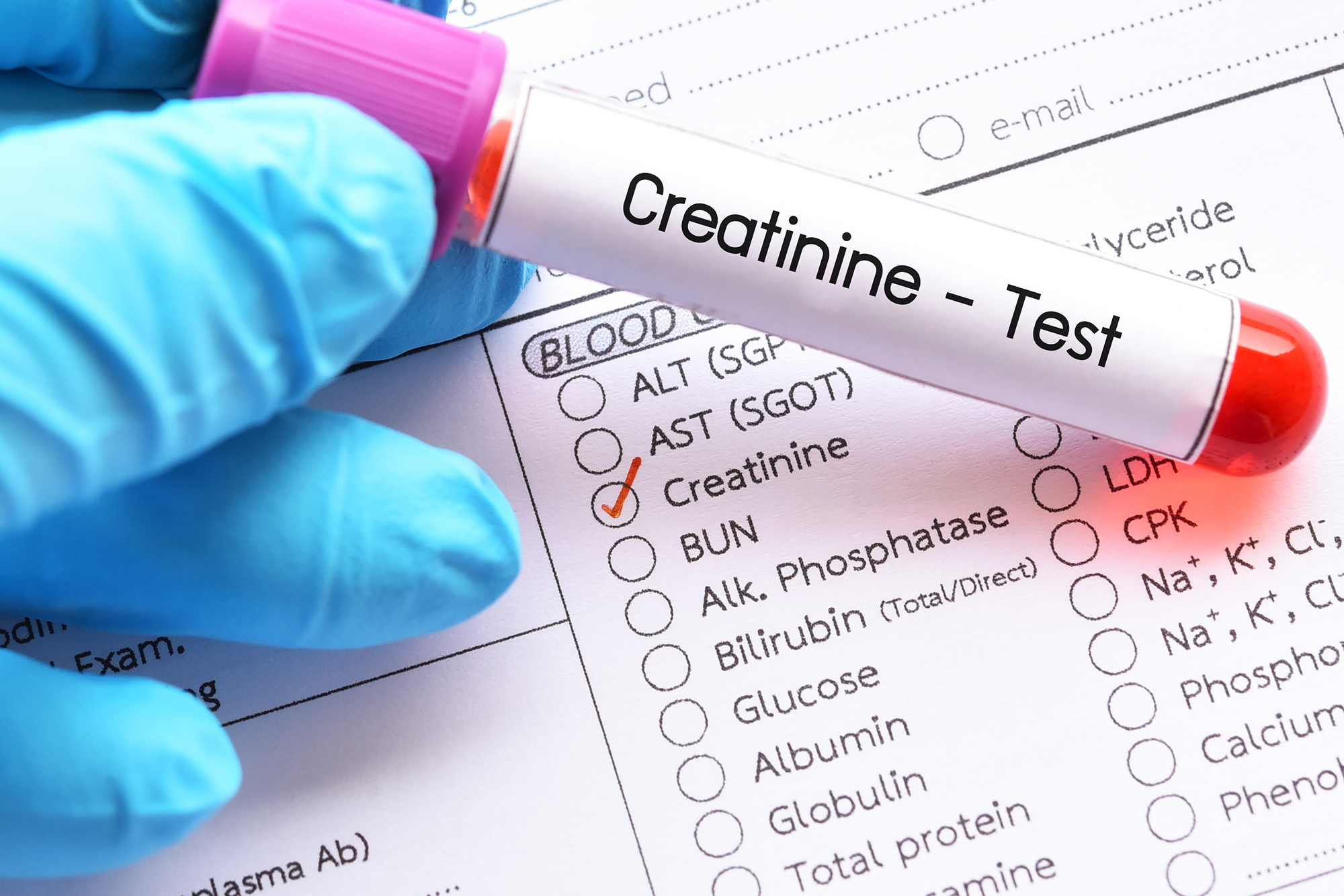 Your Creatinine Is Not Just a Number — It’s a Message From Your Kidneys